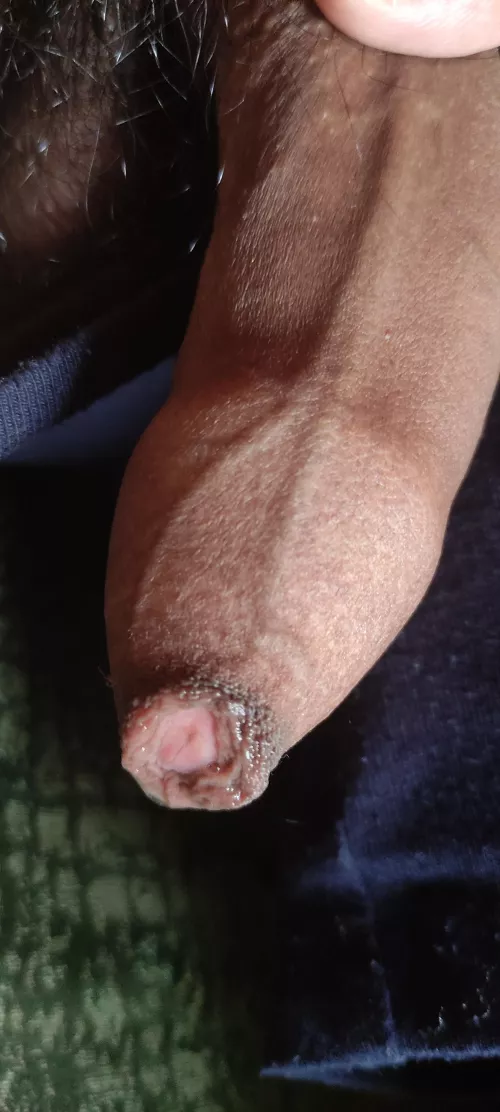 My uncut dick wet with precum...