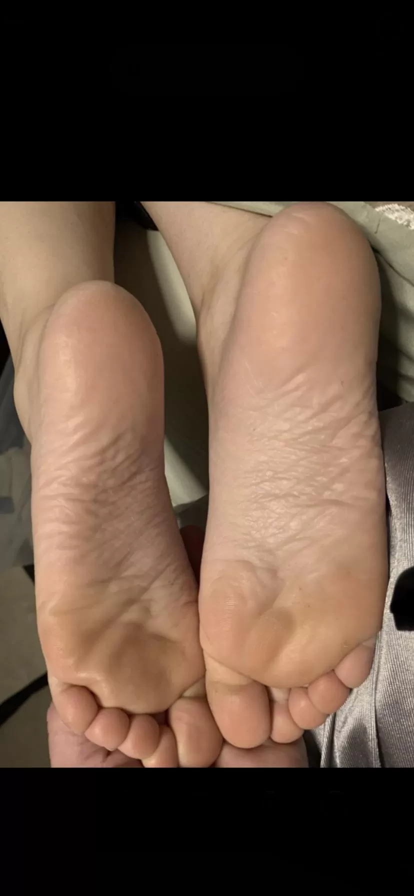 My wife’s wrinkly soles