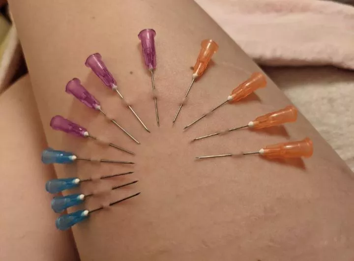 Needle decoration on my leg