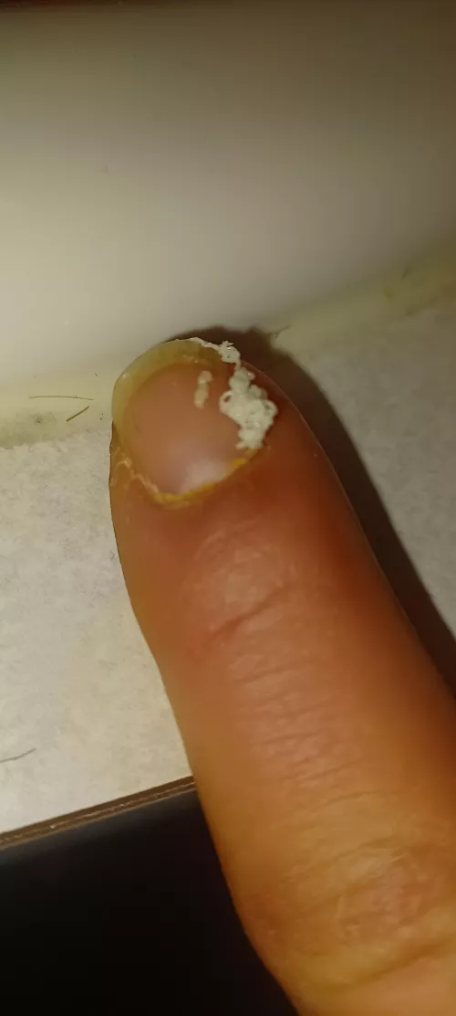 Neverending serpent. Came out aggressive.