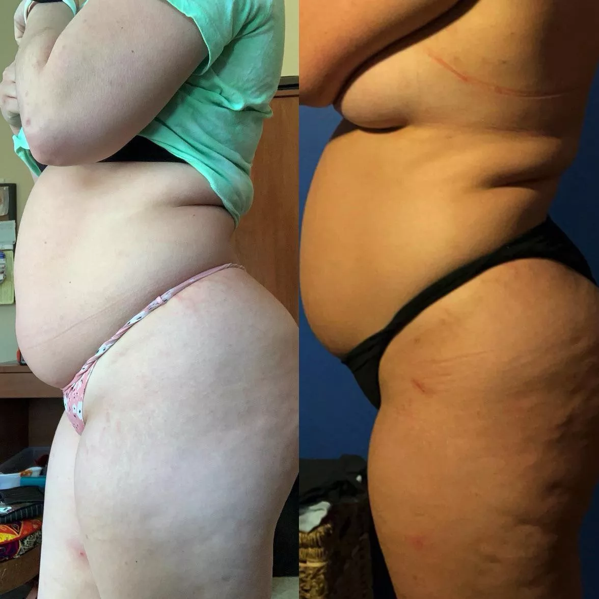 new here showing off my gfs quarantine gain. Much more to come new here showing off my gfs quarantine gain. Much more to come