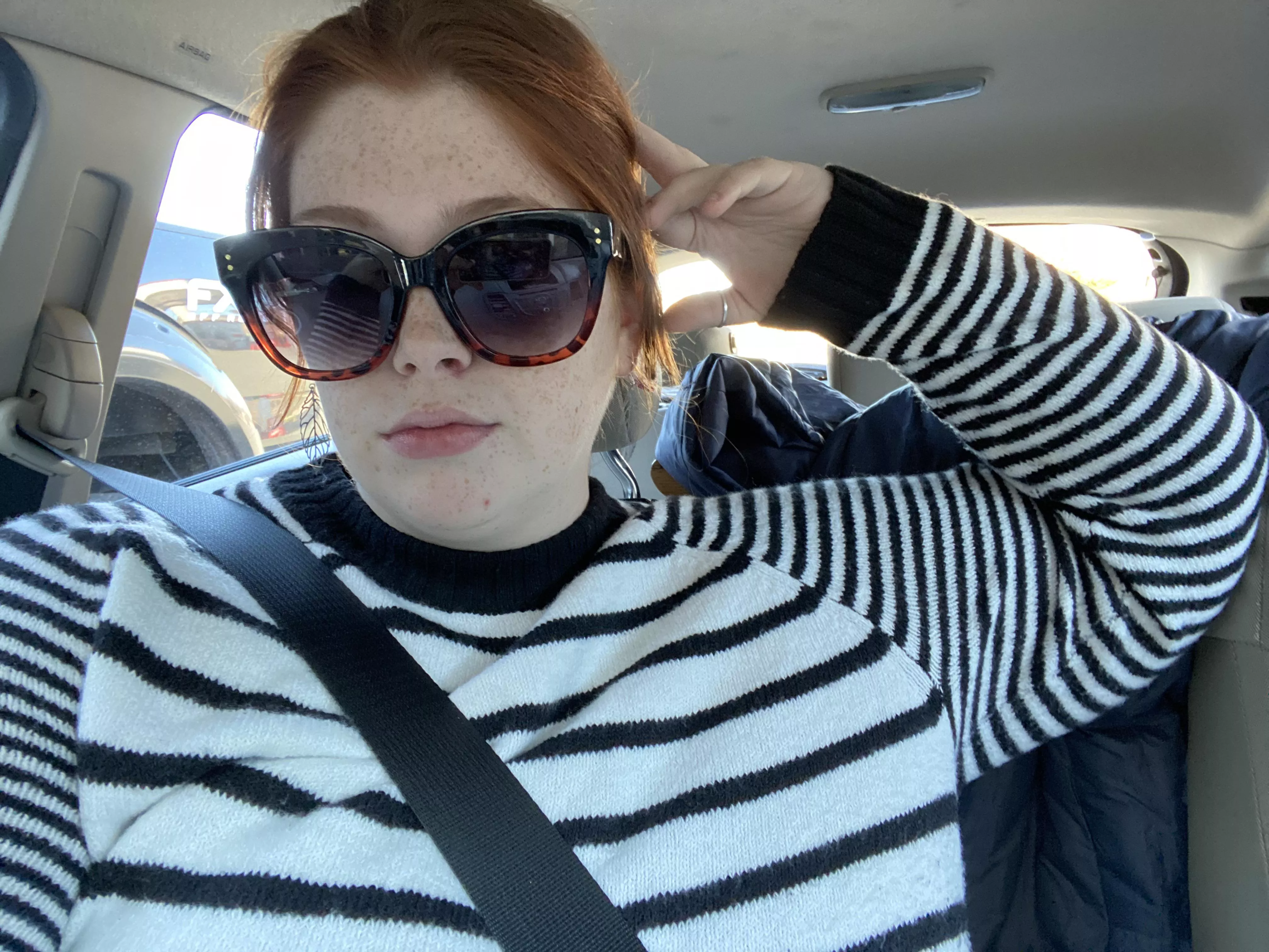 Not particularly sexy but best picture of my freckles in a whillle Not particularly sexy but best picture of my freckles in a whillle