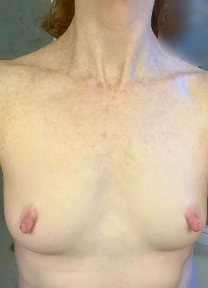 Not the biggest boobs but I love my freckles.