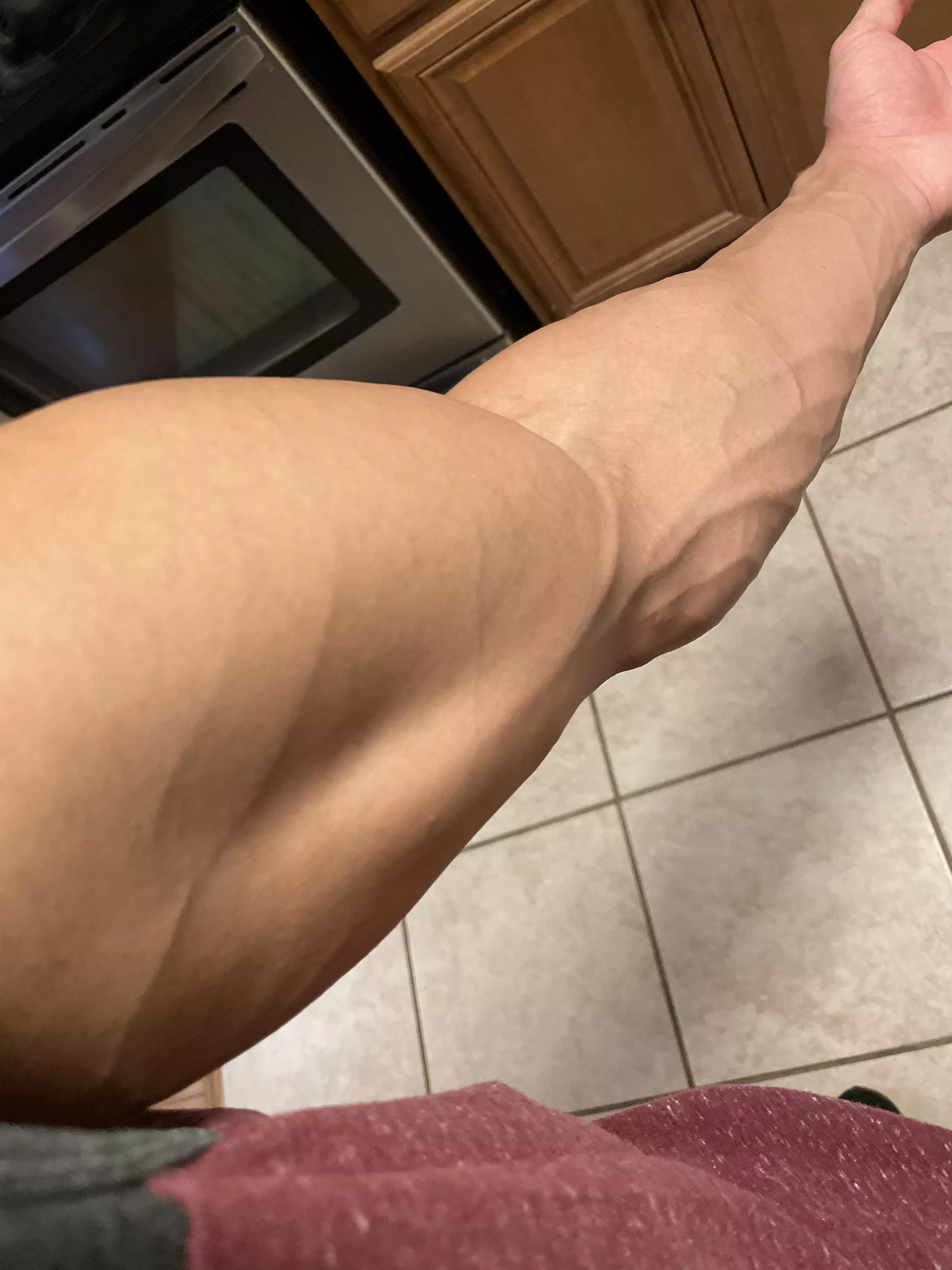 nurse still had a problem finding the vein 🤨