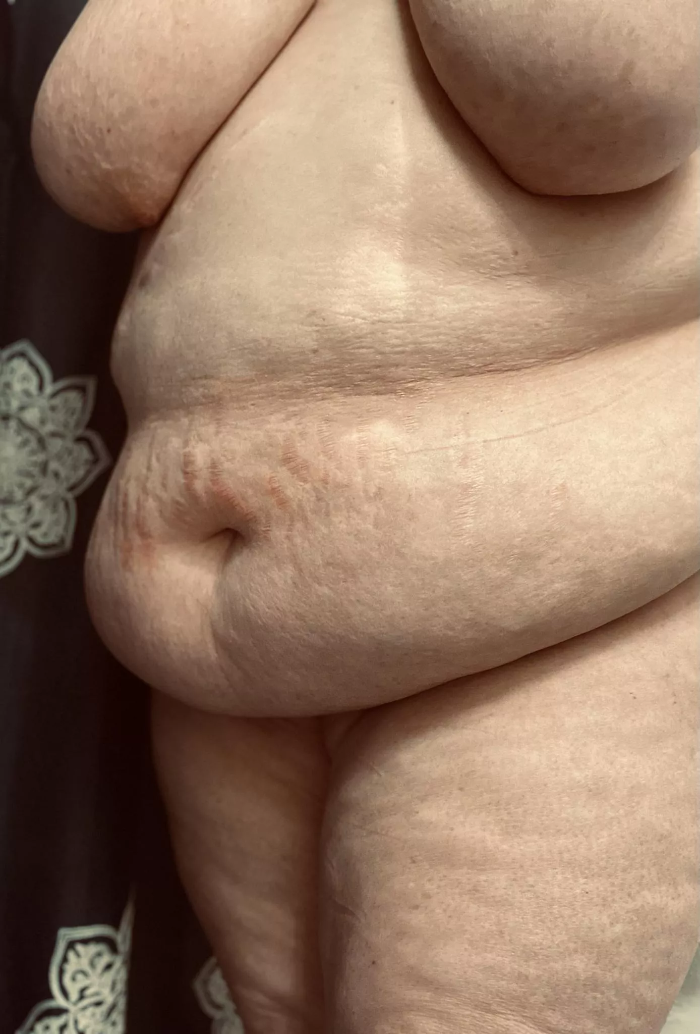 Obsessed with these stretch marks