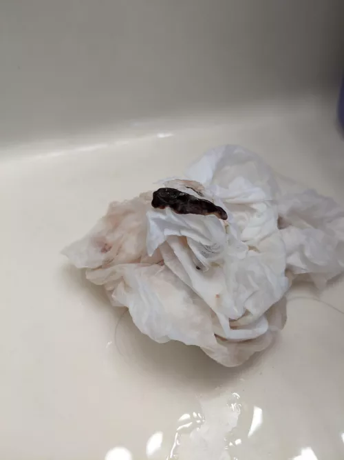 OC: post septoplasty clot. Apparently my sister blows these bad boys out multiple times daily since the surgery. This one included a bit of a broken stint at its core.