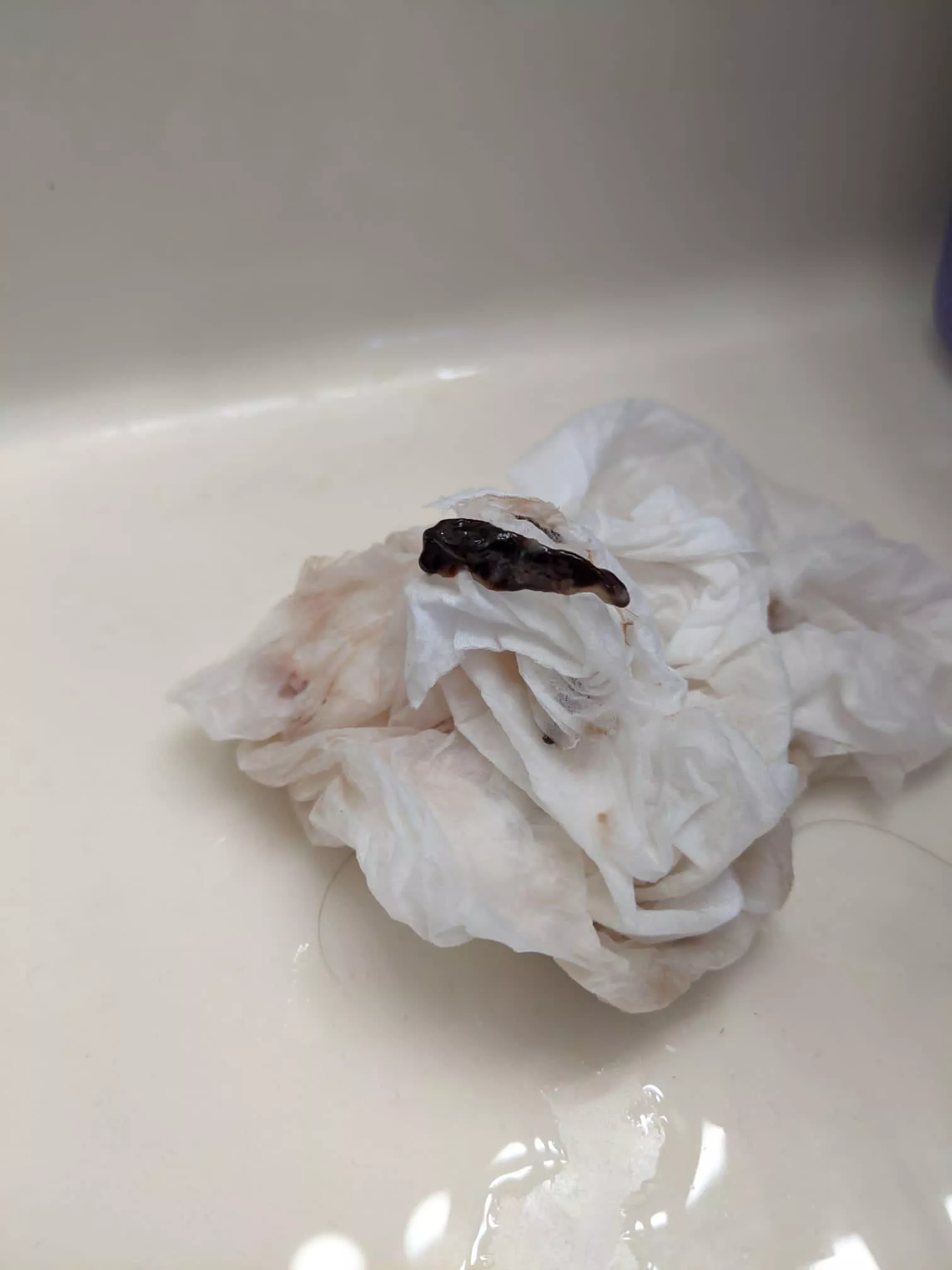 OC: post septoplasty clot. Apparently my sister blows these bad boys out multiple times daily since the surgery. This one included a bit of a broken stint at its core.