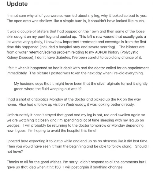 Off to the hospital! My wound is doing much better and the normal swelling is down but the back of my leg around the knee has gotten huge and we don’t know why. I’ll try to post if I can but don’t count on it for a while. (Note posted just to have 