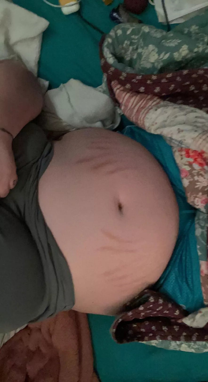 Oh my god. Look at how red my stretch marks are after my massive stuffing last night. Dms open