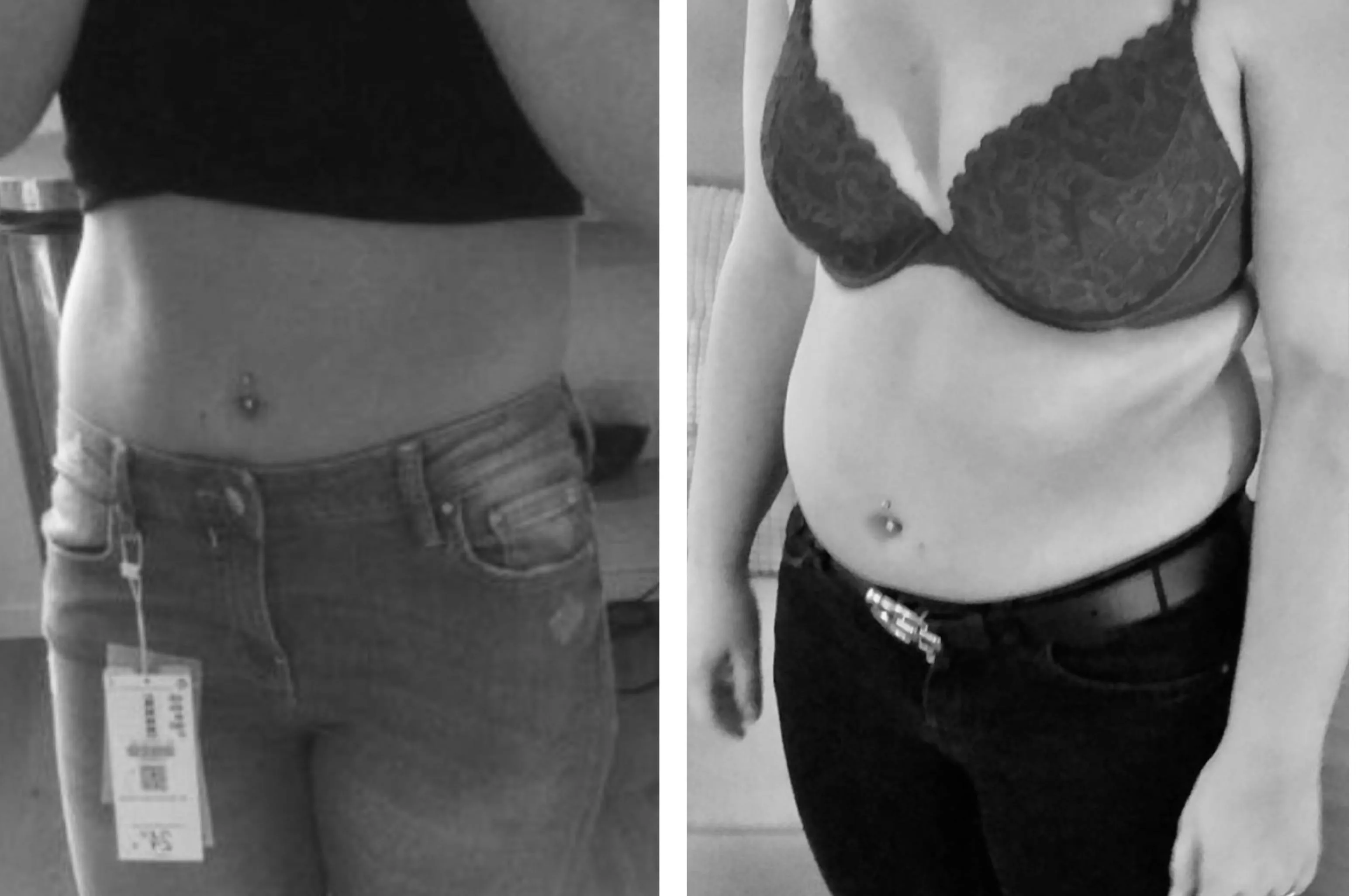 On a scale of 1-10 How noticeable is it? On a scale of 1-10 How noticeable is it?