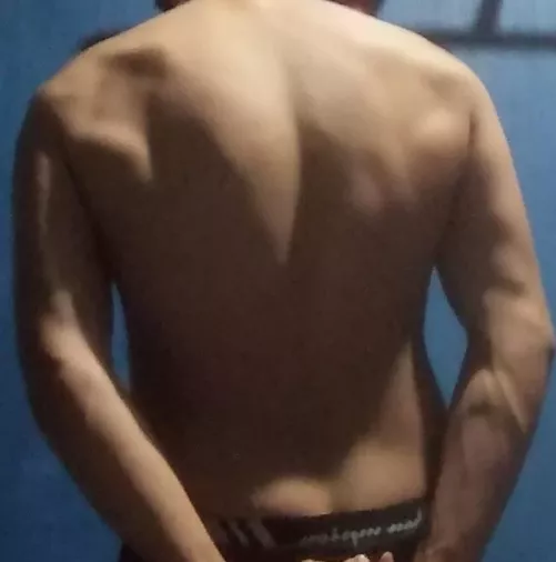 Only one of my forearms is angry