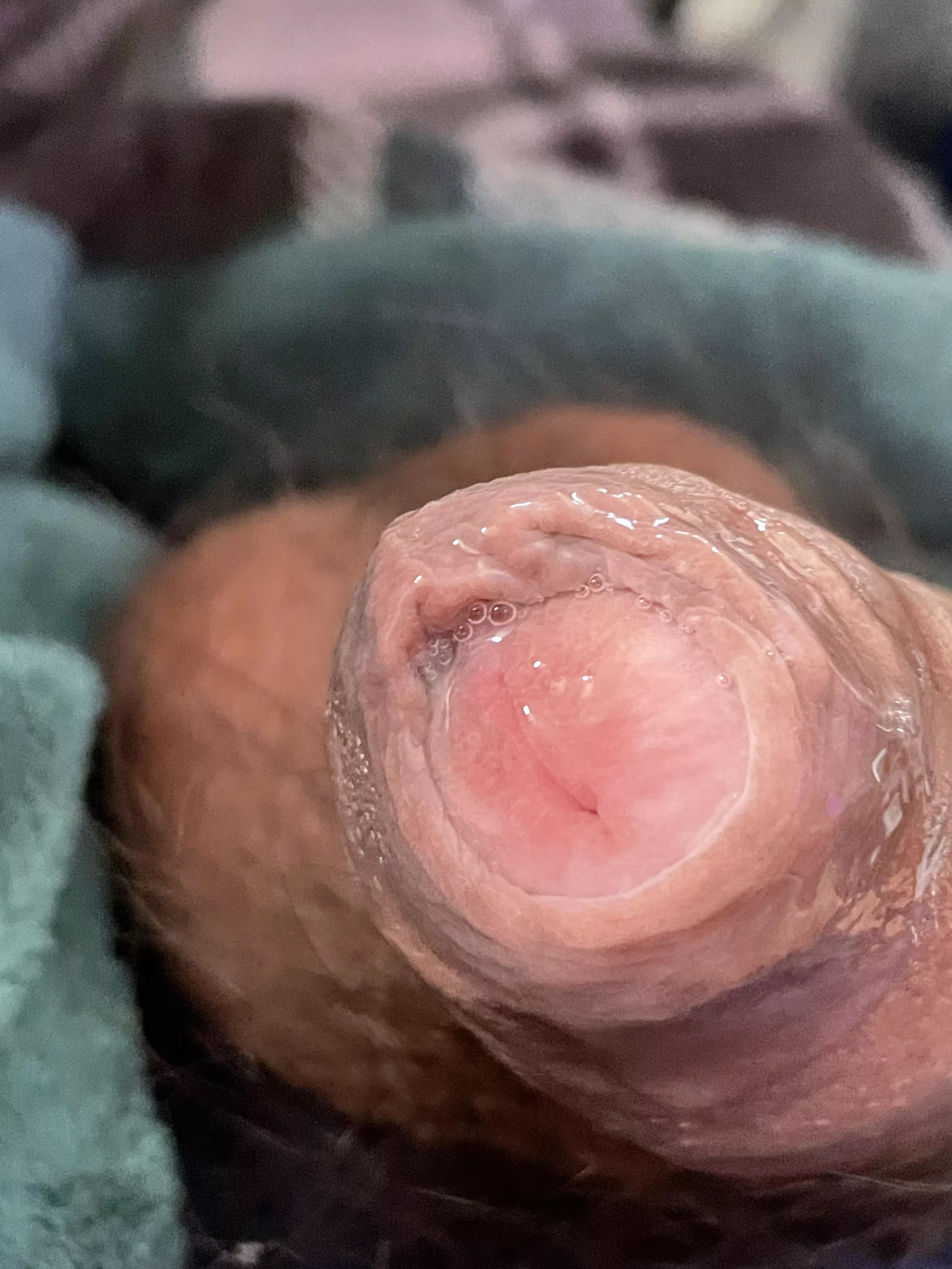 Overflow pools in the skin