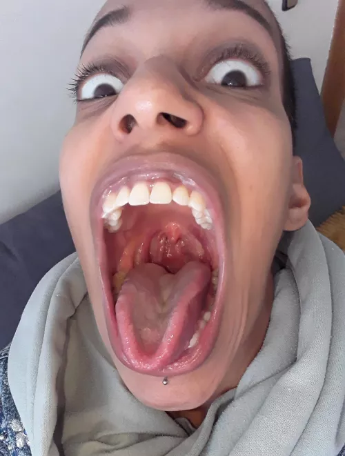 Park is open. Slide on down.