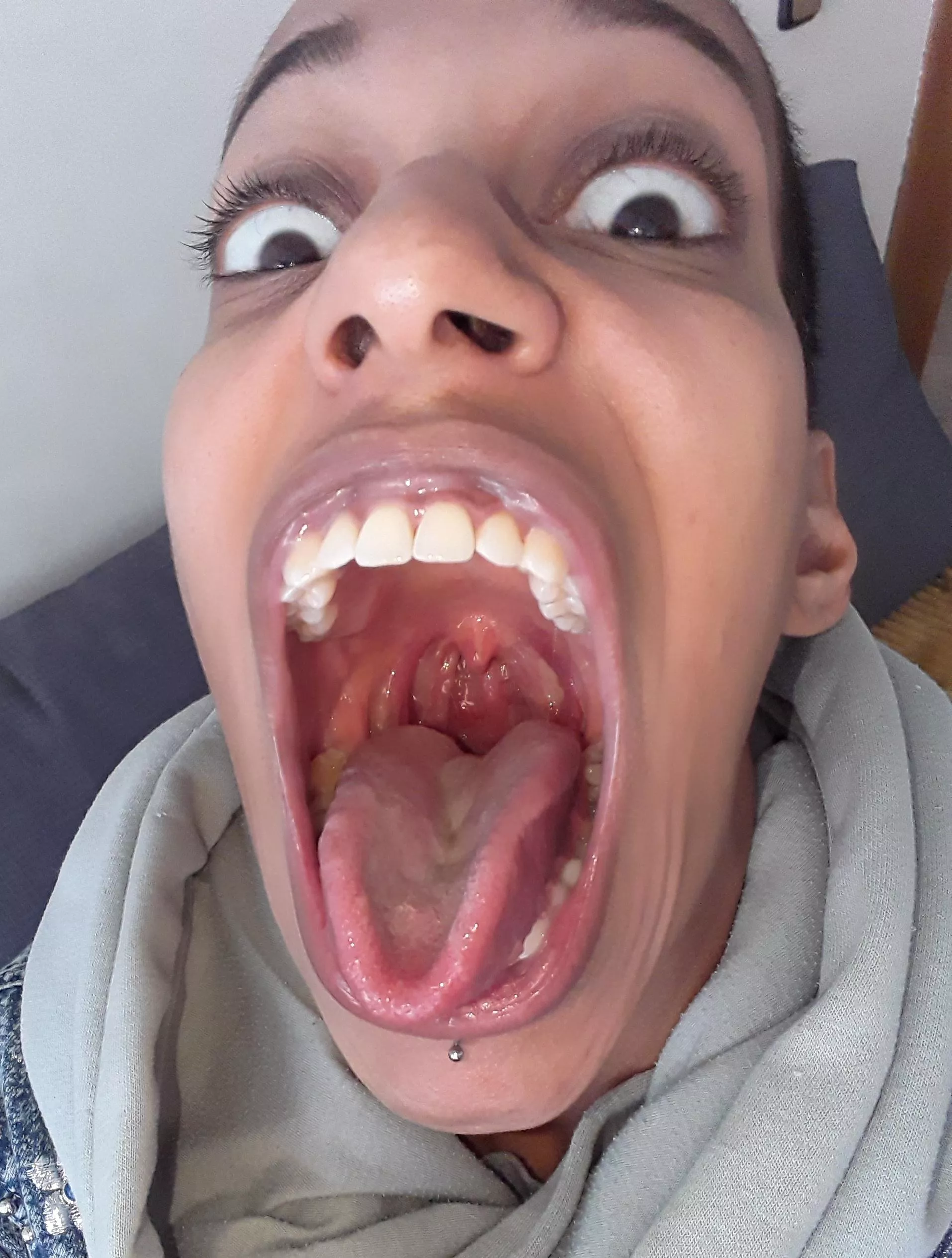 Park is open. Slide on down.