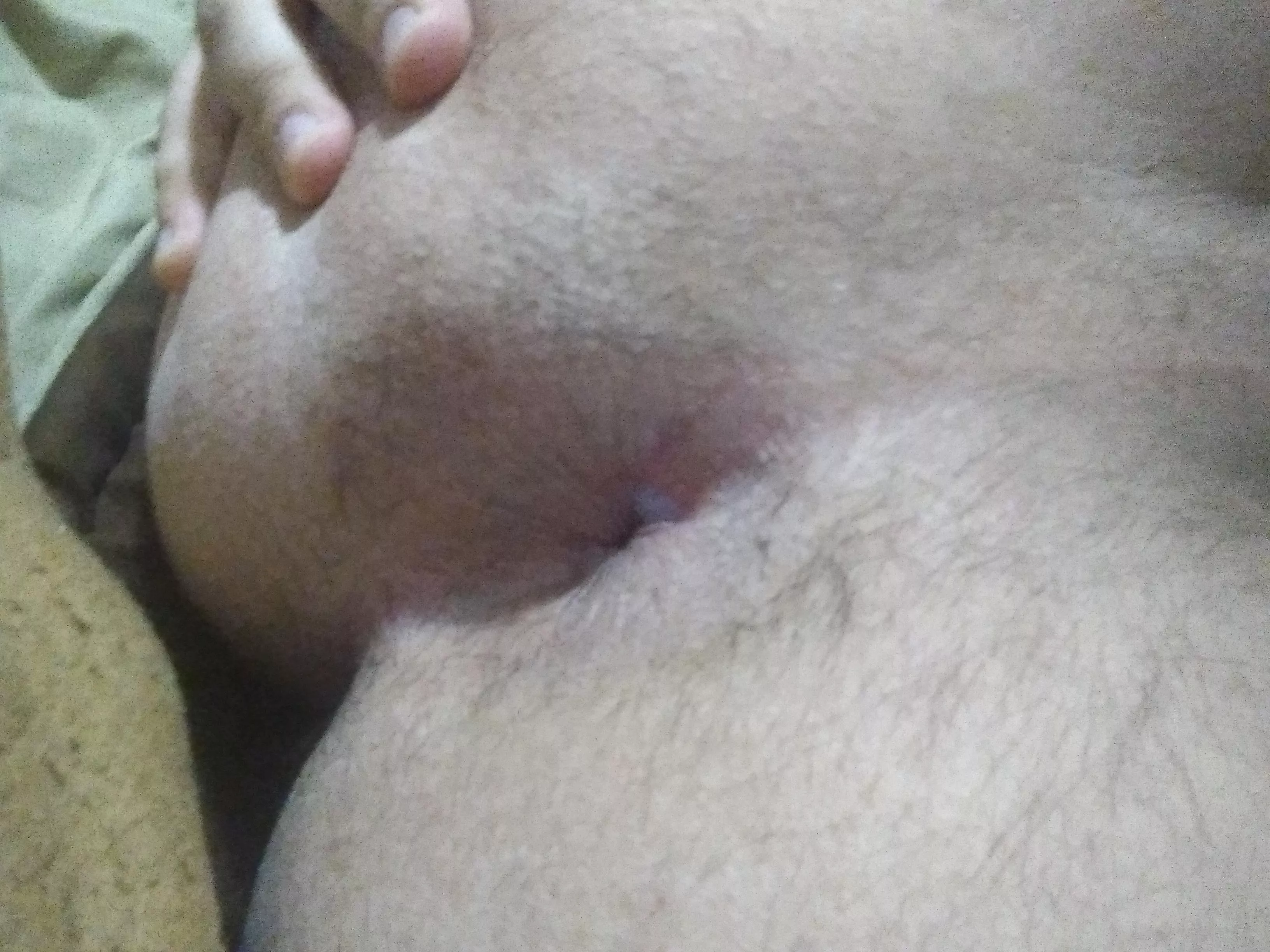 Peach fuzz coming in 🍑 Should I let it grow?