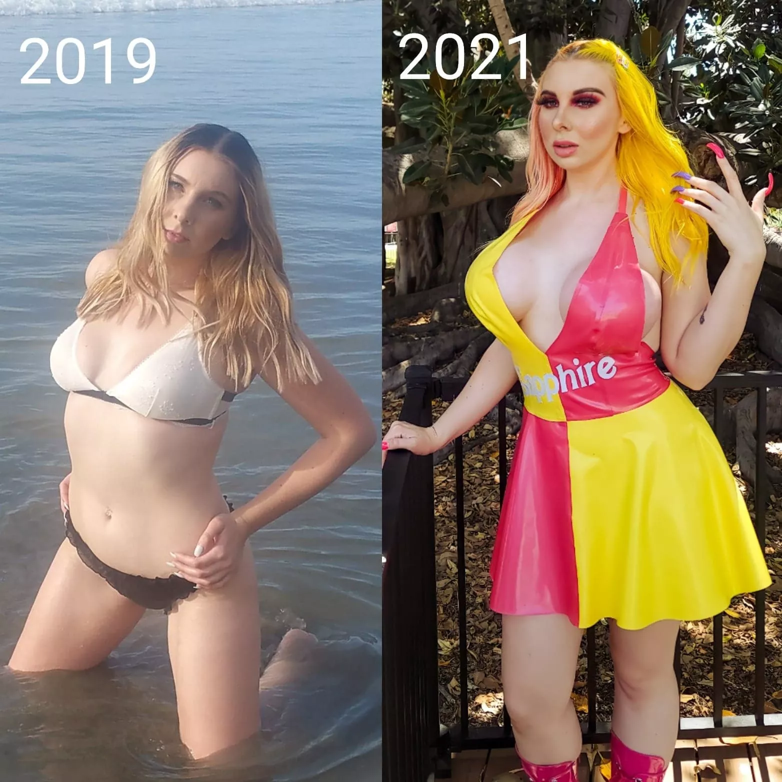 Plastic surgery schedule: fillers monthly, October- BBL, January- MUCH BIGGER implants(I just cant help myself), june 2021-facial reconstruction. Plastic surgery schedule: fillers monthly, October- BBL, January- MUCH BIGGER implants(I just cant help myself), june 2021-facial reconstruction.