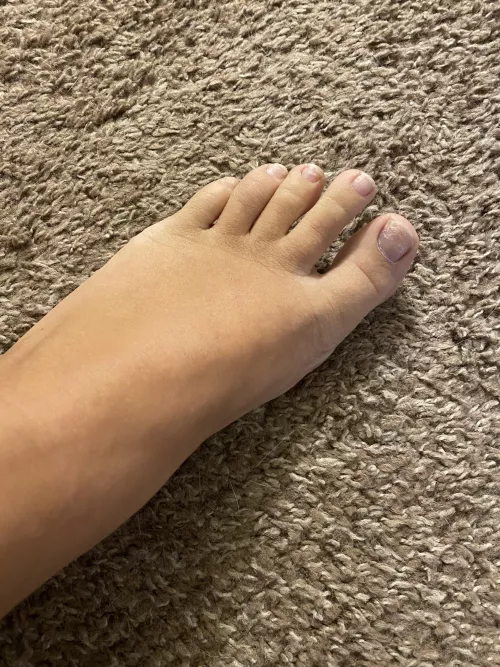 Please help my feet!