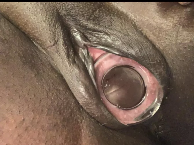 Plug my hole