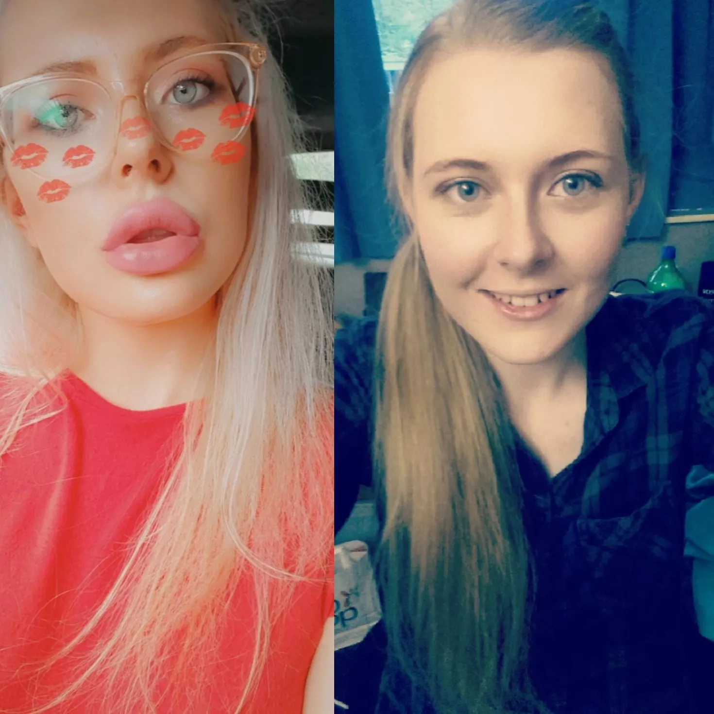 Plumped up my a little more yesterday  what do you all think???? Plumped up my a little more yesterday  what do you all think????