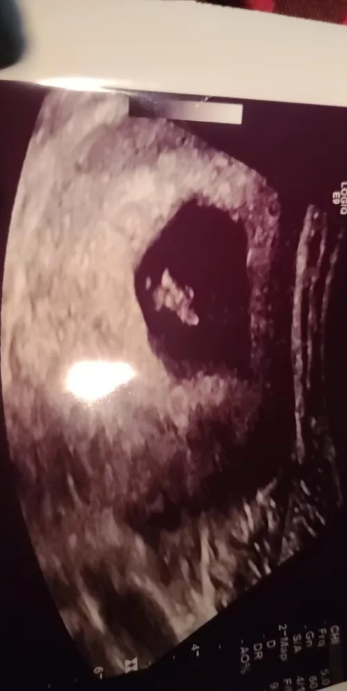 Positive Test at 11 days! Y'all get me my Whole Pregnancy this time! 7wks 4d