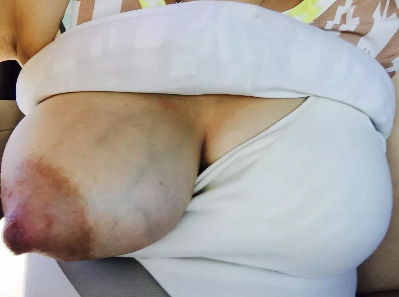 Pregnancy tits getting ready for feedings. Last post was deleted on accident.