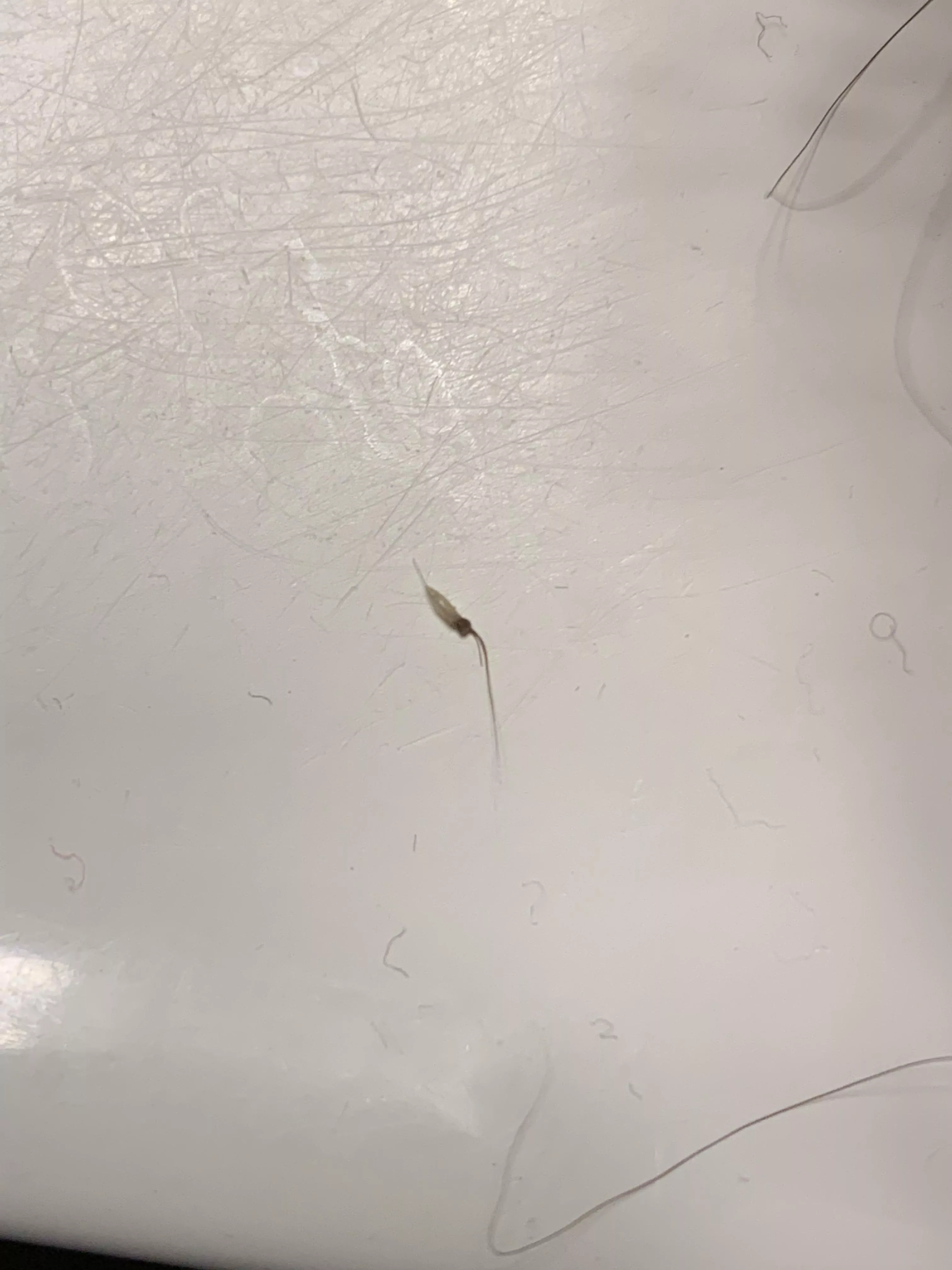 Pulled this little guy out from my pubic area