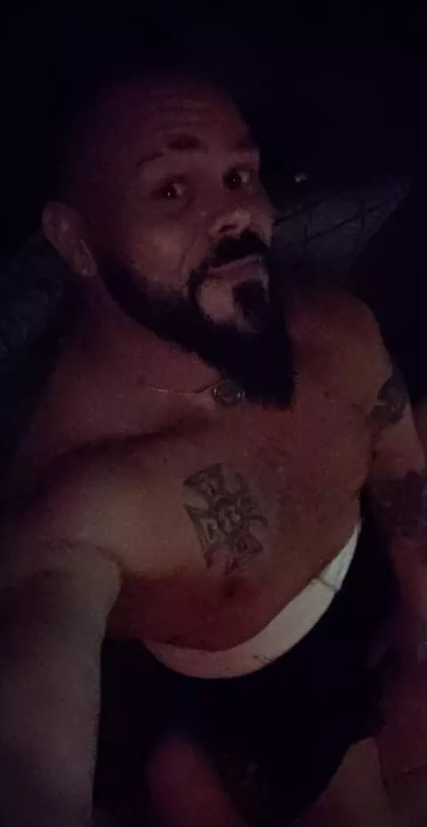 Recovery from surgery...any takers to kiss it and make it better? 😉😈