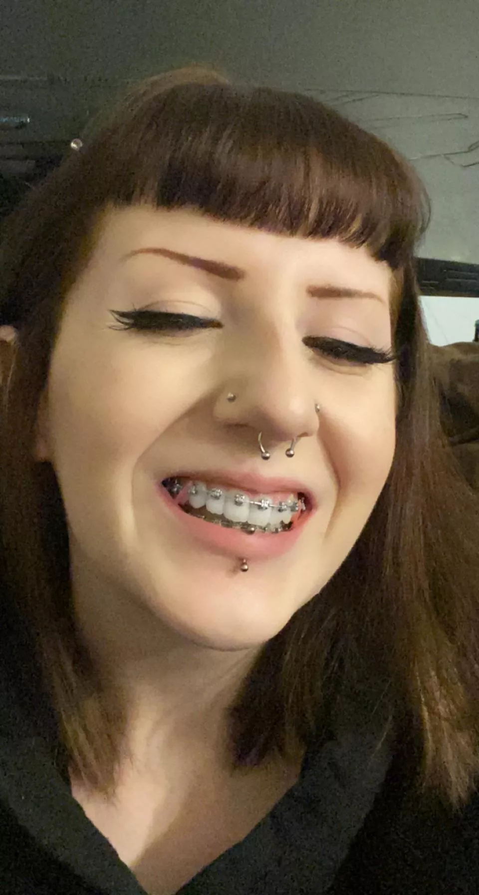 Remembering to wear my bands!