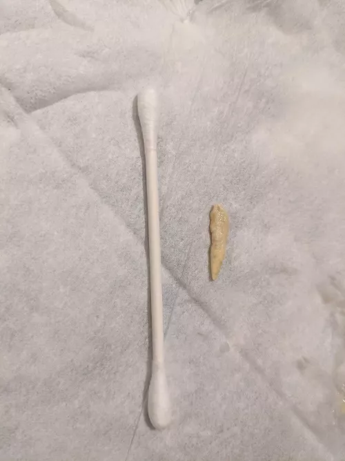 Right eye wasn't draining tears for almost 2 weeks.