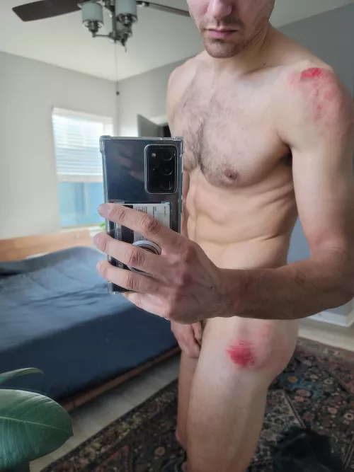 Ringing in the new year right with a bike crash π