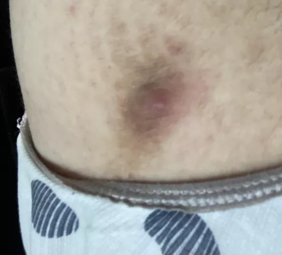 Say Hi To My Third Nipple!