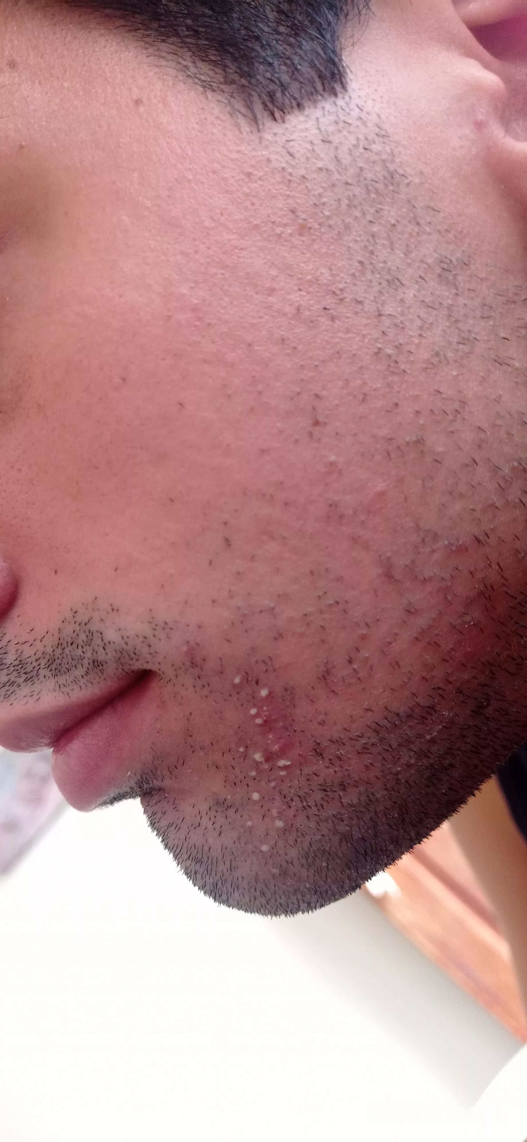 Shall i pop them all?