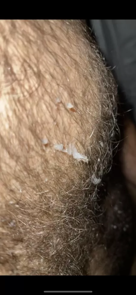 Shot up to my neck and covered my chest hair last night π¦ video on my OF π