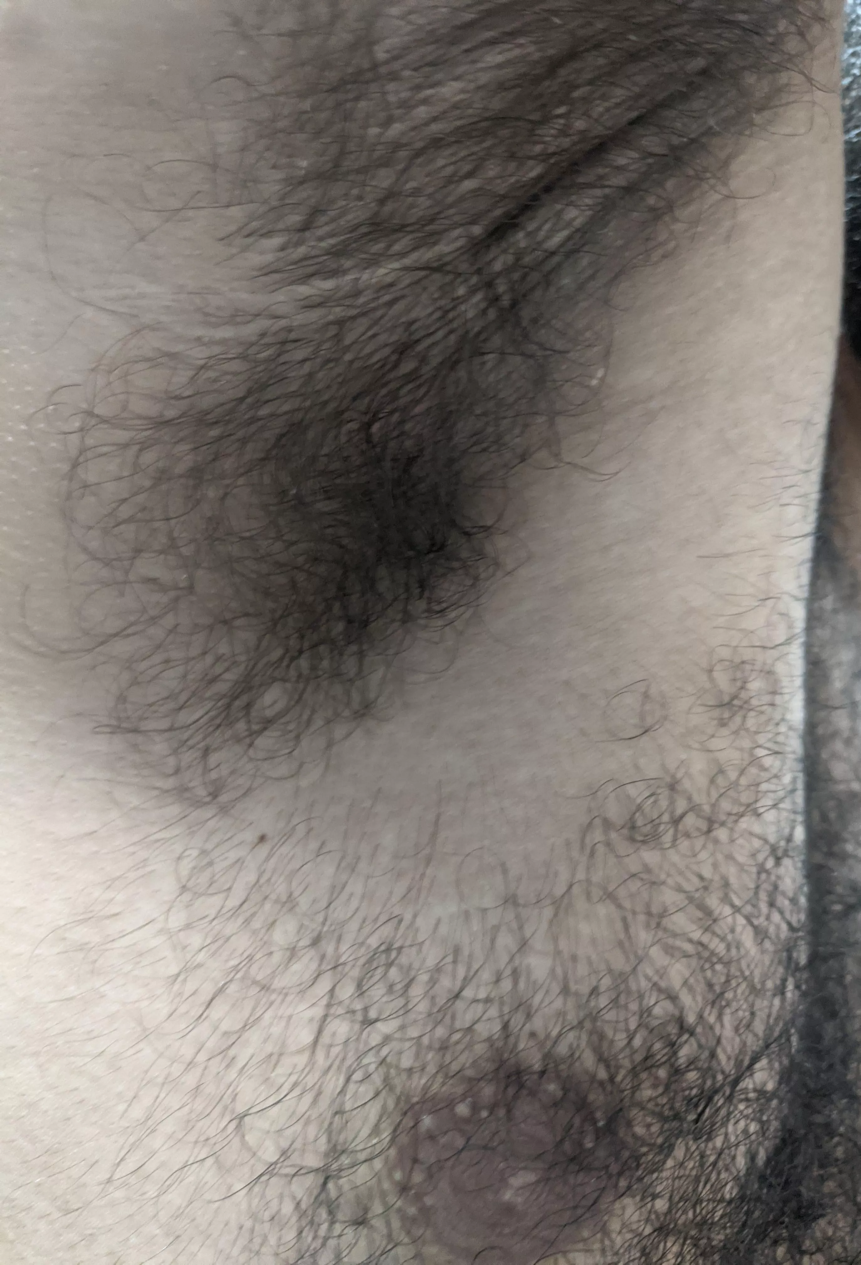 Should I shave it or not? Should I shave it or not?