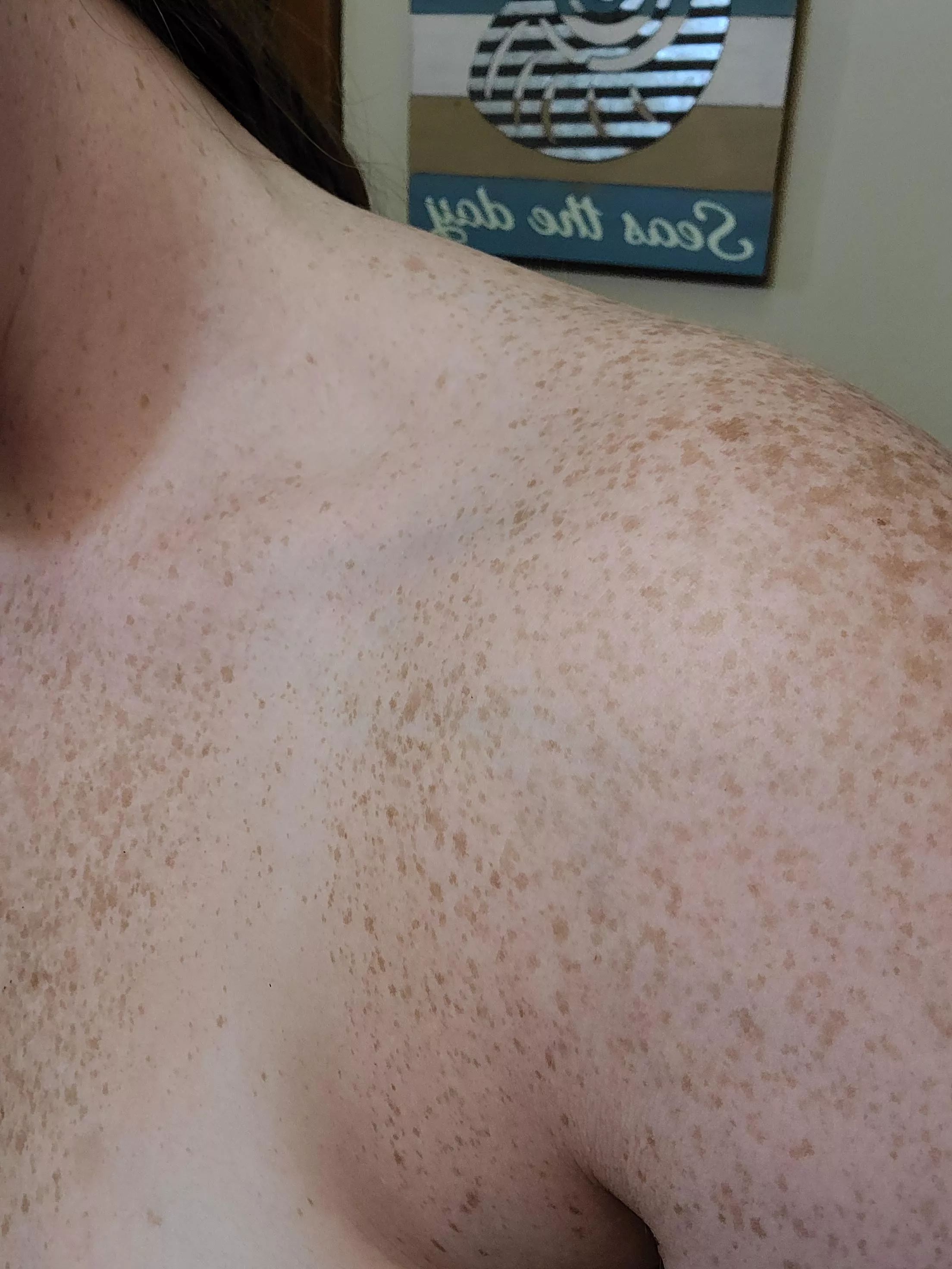 shoulder freckies