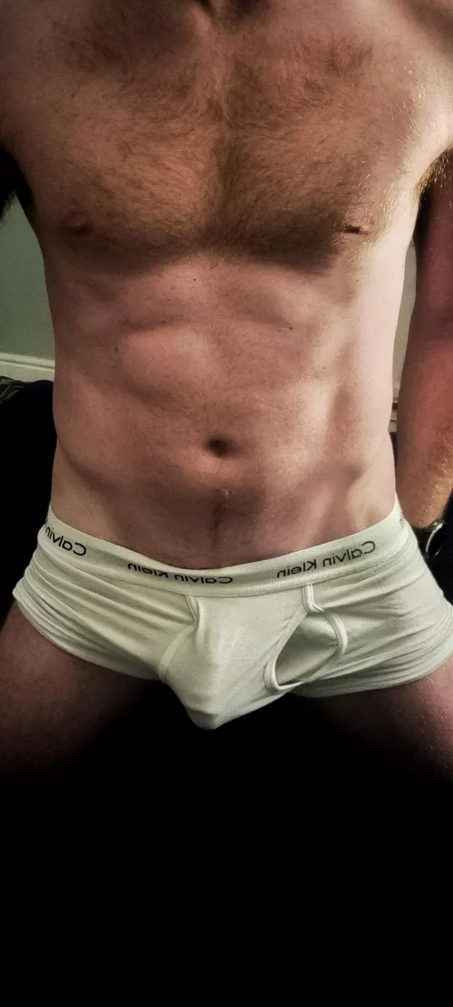 Soft bulge
