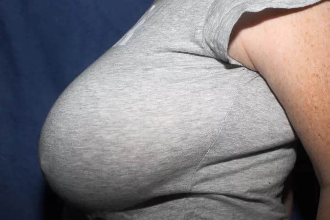 Some of you wanted to see a profile view? 💖