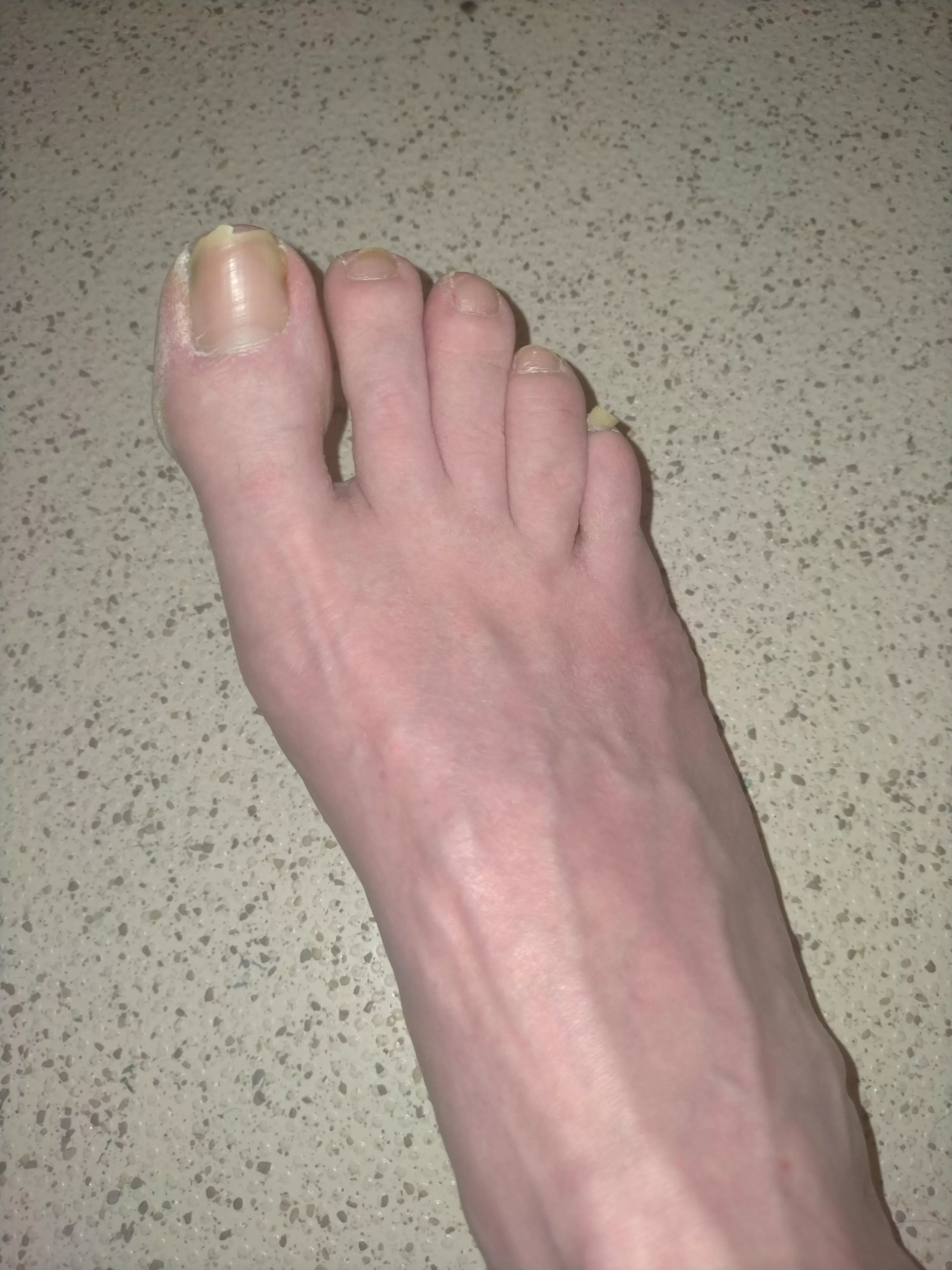 Someone play with my dirty size 13 (UK) feet.