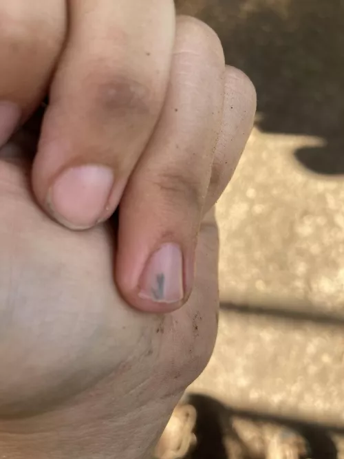 Sorry about the dirty hands. Just finished work. Think I can get this splinter out on my own?