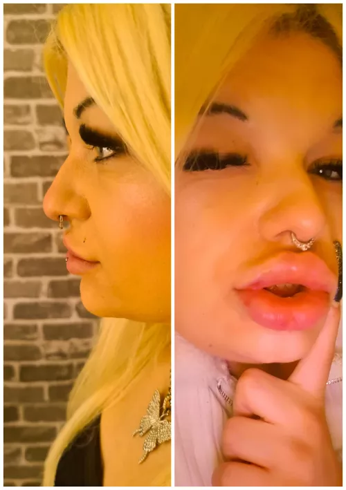 Still need more Injections for perfect DSLs 🥰