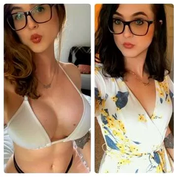 Super hpapy with how my boob job turned out! Lips are next Super hpapy with how my boob job turned out! Lips are next