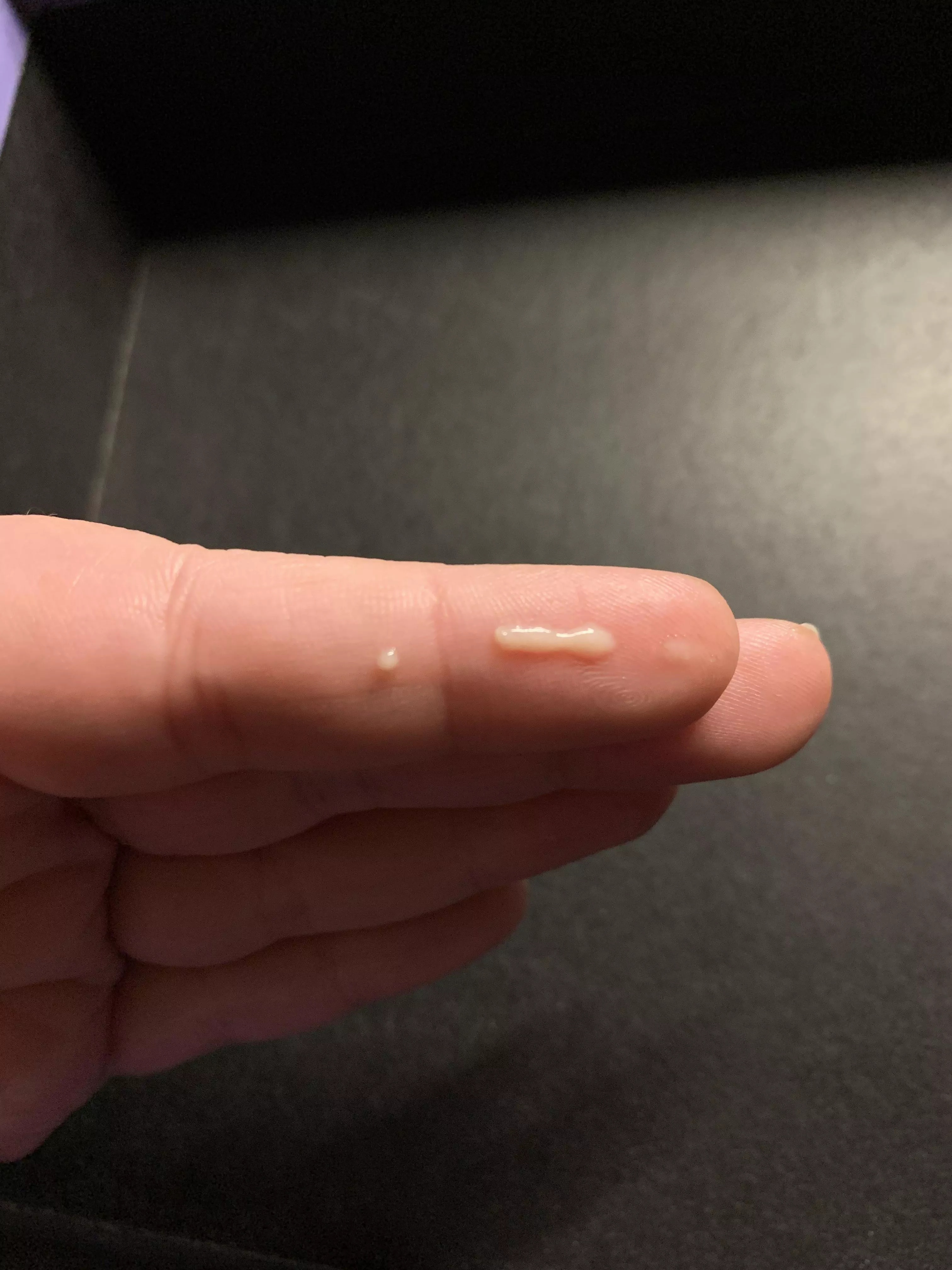 Surprise thigh pimple explosion