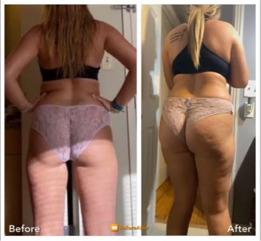 That’s one way of making an oversized pair of panties fit 😏😂