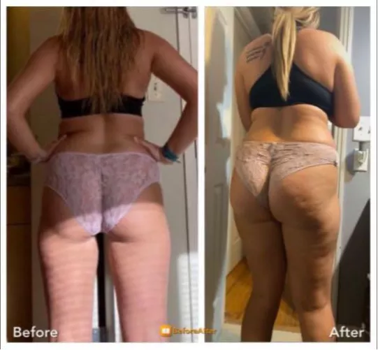 That’s one way of making an oversized pair of panties fit 😏😂