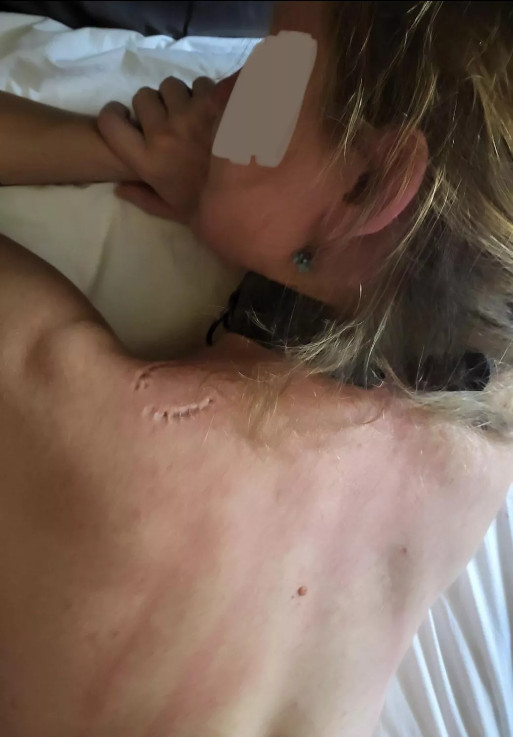 The collar and bite mark are just proo[f]] that I belong to daddy!!