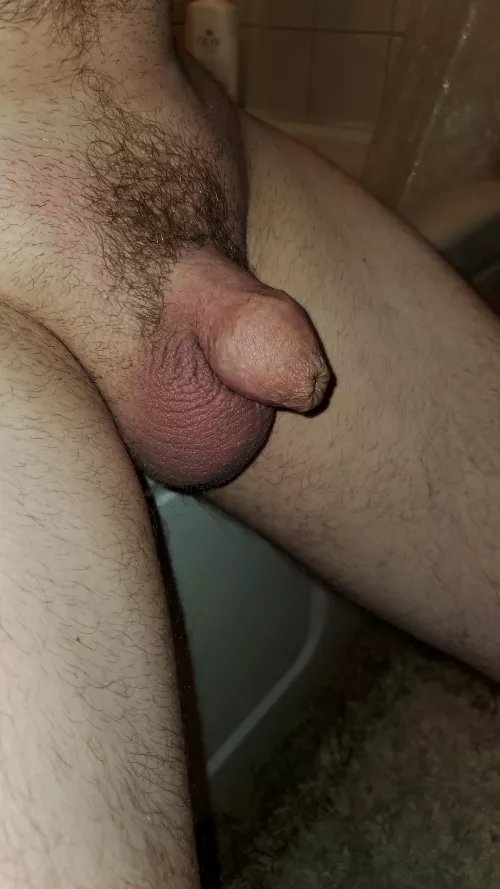 The most embarrassing thing is getting an unexpected hernia exam by a young female intern who smirks the whole time while my tiny little penis is on display. (26)