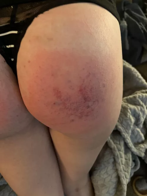 The paddle made another appearance today. She took her spankings like a good girl. Her ass will be sore for a few days.