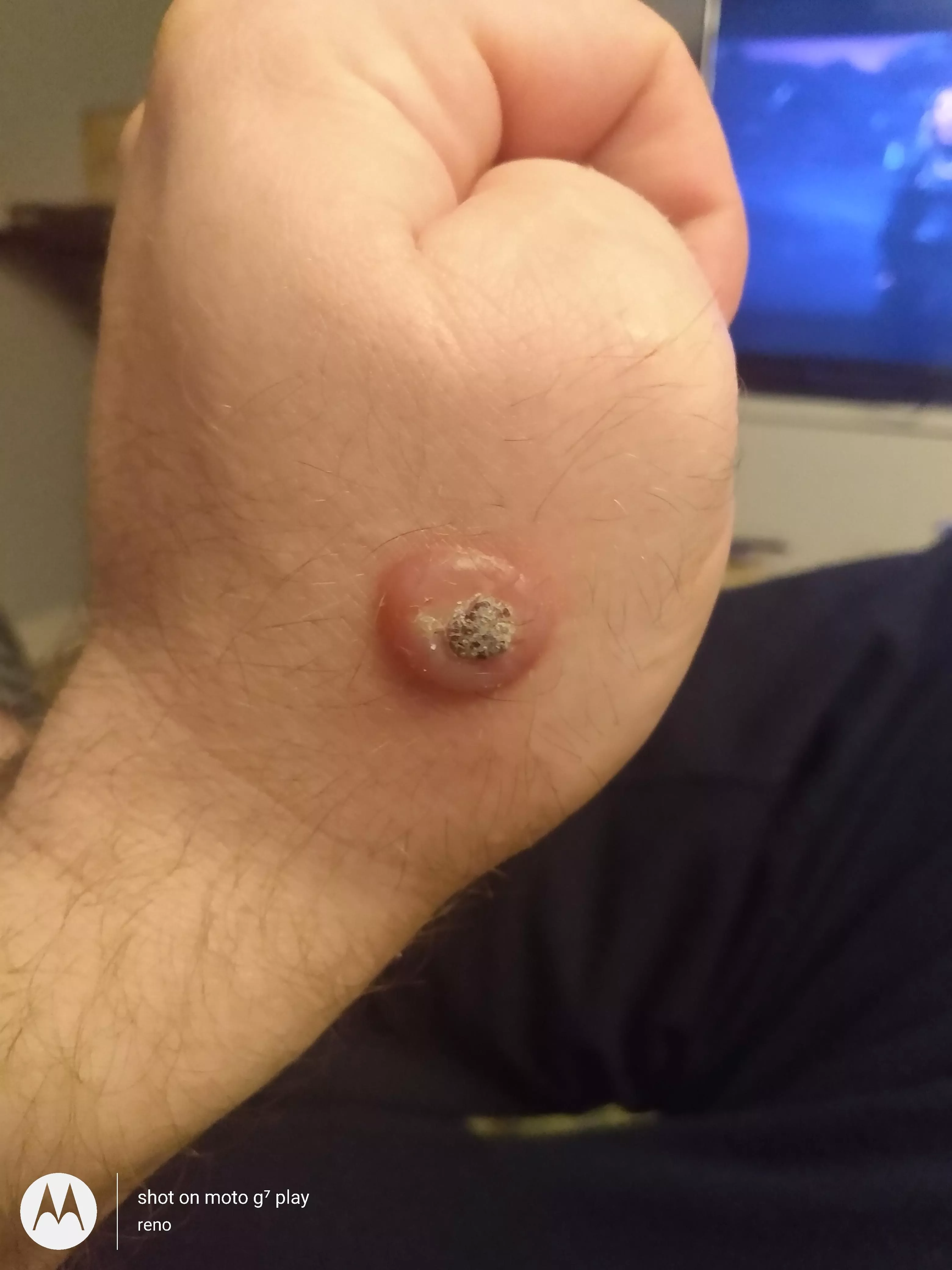 The temptation is real