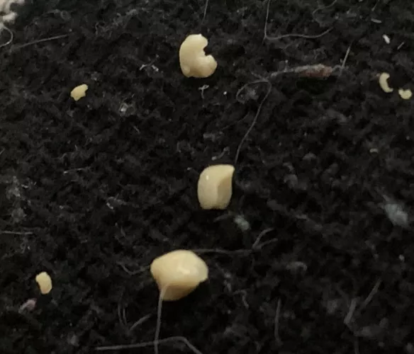 These tonsil stones decided that it was time to shine. The biggest one is the size of my fingernail!