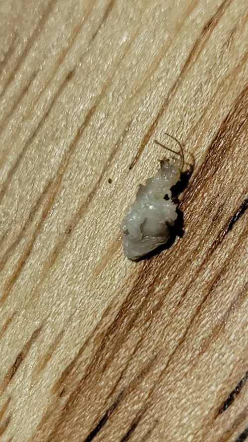 This came out while pulling out an ingrown hair